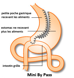 Le centre d’amincissement anti-âge Hélène Galé spécialisé dans la presso thérapie, drainage lymphatique et les jambes lourdes vous propose la cryolipolyse pour mincir et maigrir pas le froid pour les hommes comme pour les femmes à Tarbes 65000 et Pau.