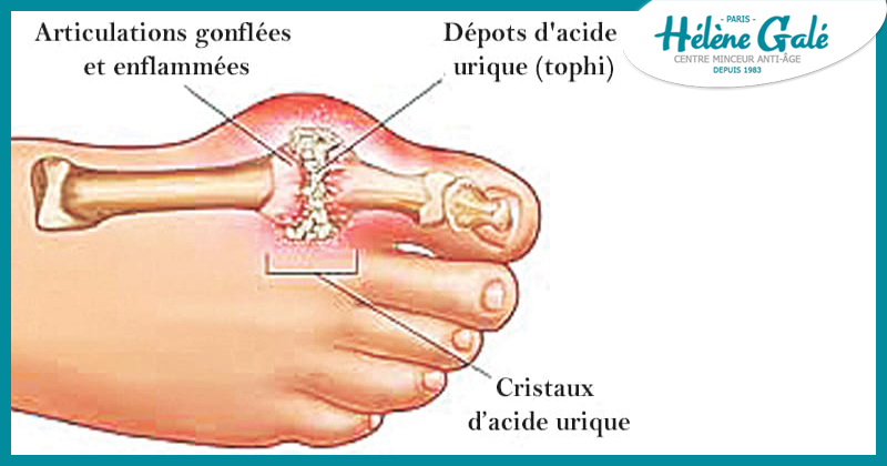 Le centre d'amincissement Hélène Galé, votre coach minceur anti-âge, vous propose de mincir ou de maigrir avec la cryolipolyse à Tarbes 65000. Supprimez la cellulite qui vous gène et profitez des soins visage et corps et des compléments alimentaires Hélène Galé !